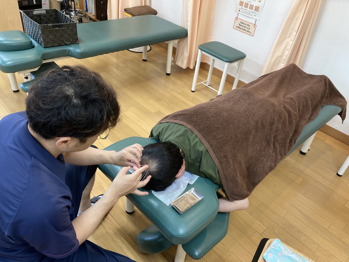 薄毛改善鍼の施術風景（施術ベッドでの施術）