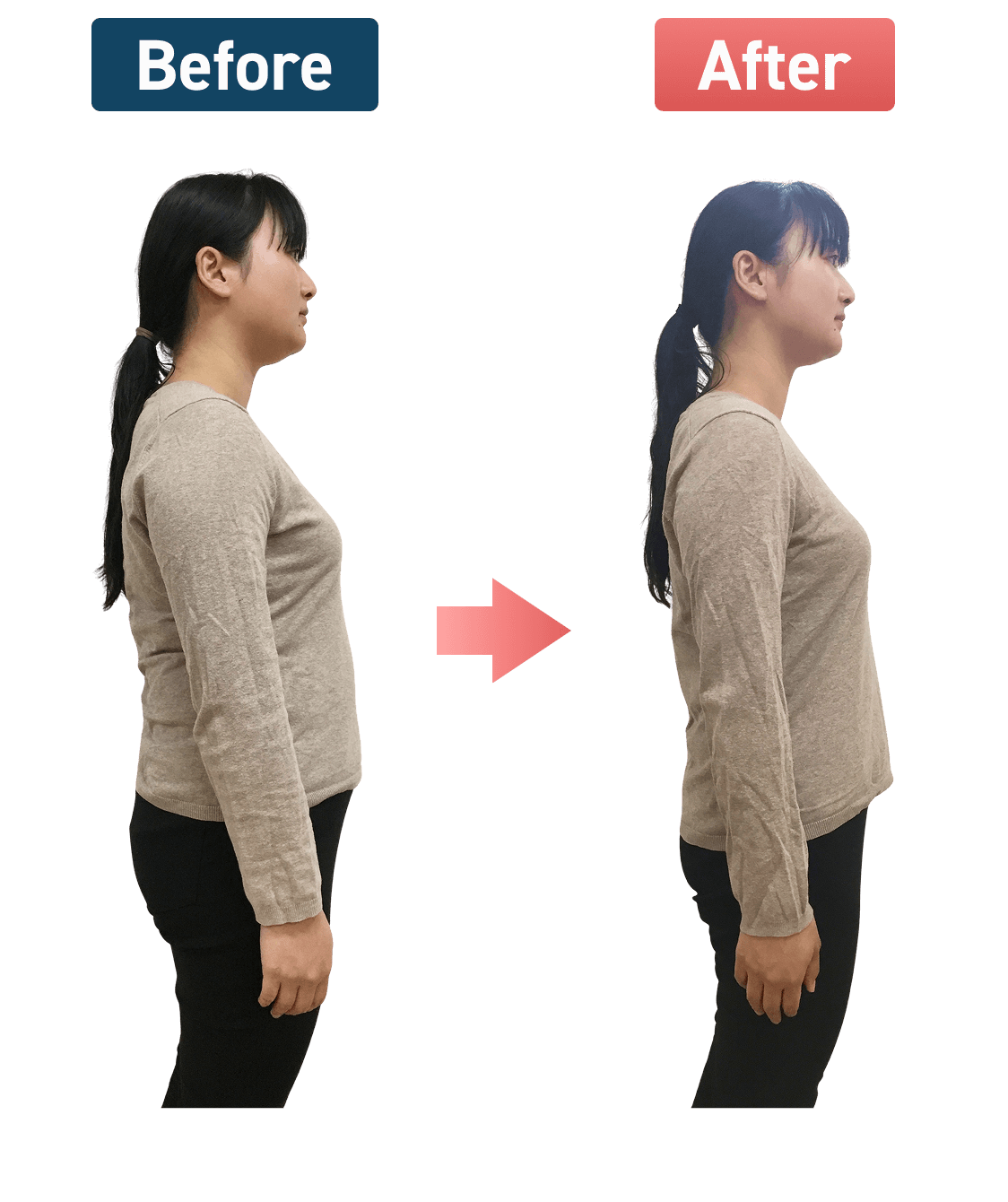 3ヶ月で10.5kg痩せたMMさまのBefore → Afterの写真（右向き）